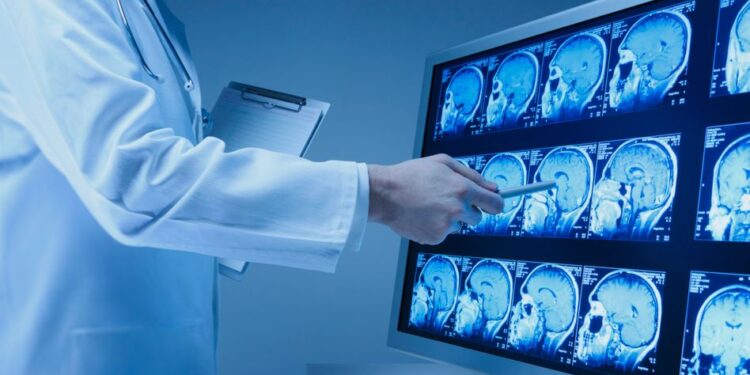 monitor displays mrt scans of a human brain --- Image by © Ocean/Corbis